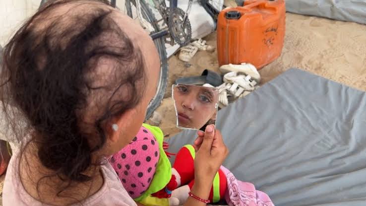 Gaza War: “A generation has been traumatized”